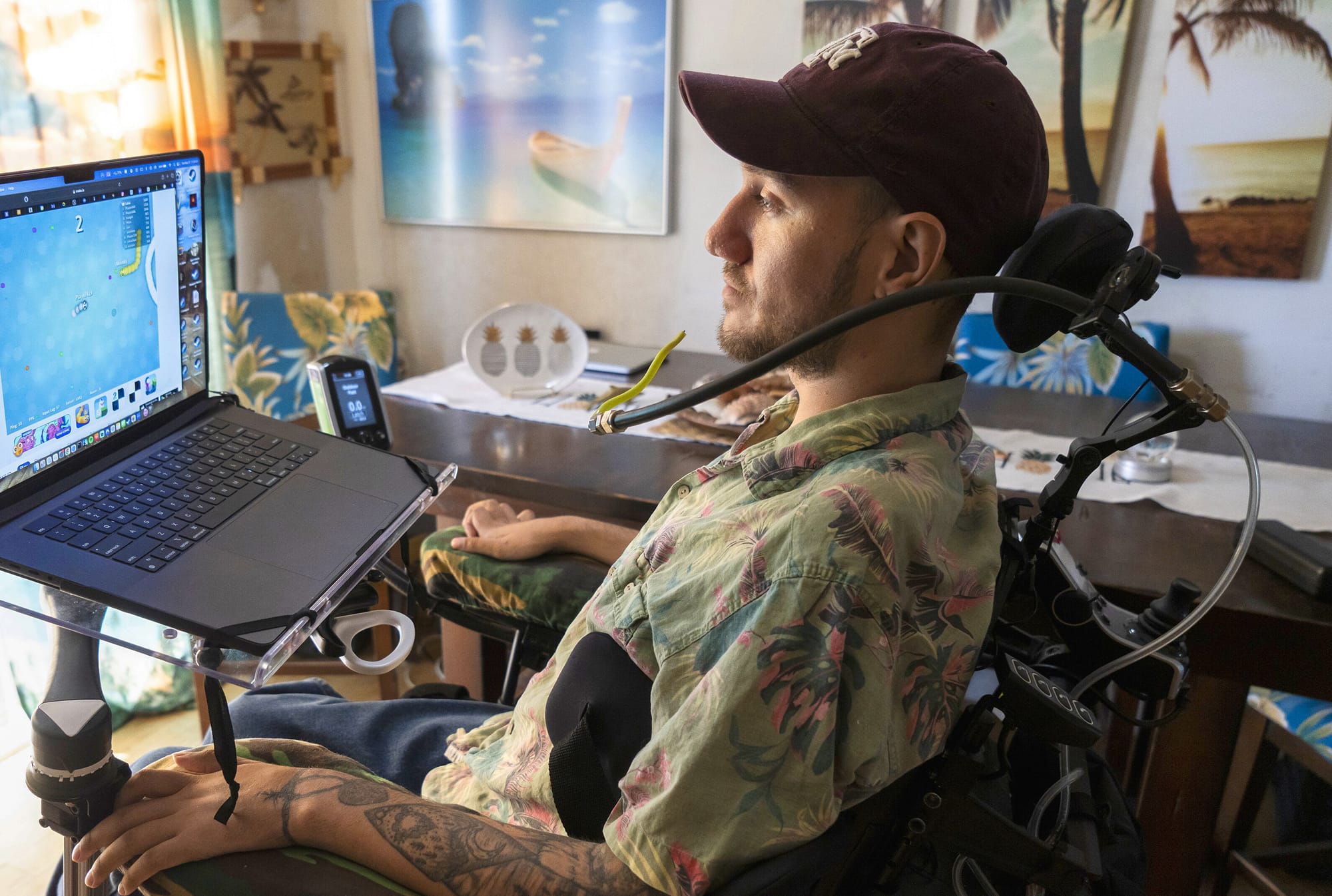 Ich machte ein Nickerchen und wachte als Cyborg auf: Wie Technologie Behinderten helfen und die Menschheit voranbringen kann